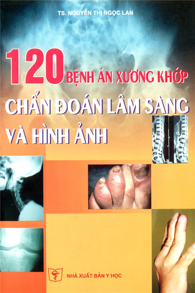 120 Bệnh Án Xương Khớp Chẩn Đoán Lâm Sàng Và Hình Ảnh (NXB Y Học 2015) -  Nguyễn Thị Ngọc Lan