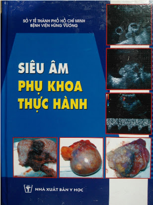 Siêu Âm Phụ Khoa Thực Hành (NXB Y học 2014) - Đỗ Danh Toàn, 215 Trang