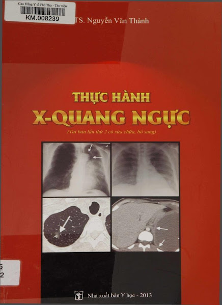 Thực Hành X-Quang Ngực (NXB Y Học 2013) - Nguyễn Văn Thành, 150 Trang